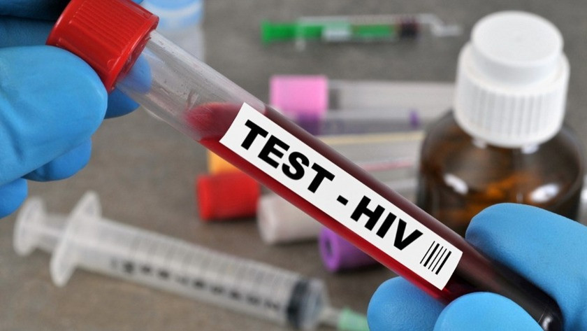 AIDS hastalığı nedir ? HIV virüsü nasıl bulaşır ?