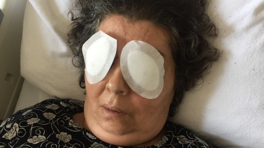 Hastanede dehşet! Şizofren kadın hastanın gözlerini çıkardı