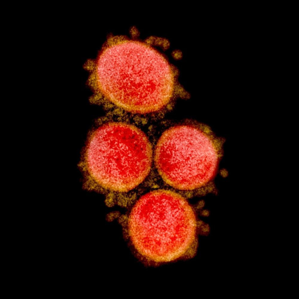 Korona virüsü hücreleri nasıl hasara uğratıyor?Adım adım görüntüler ABD laboratuarında kaydedildi! - Sayfa 3