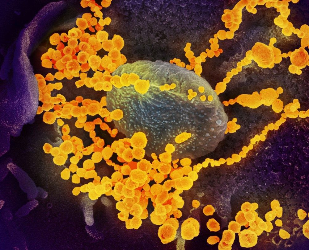 Korona virüsü hücreleri nasıl hasara uğratıyor?Adım adım görüntüler ABD laboratuarında kaydedildi! - Sayfa 1
