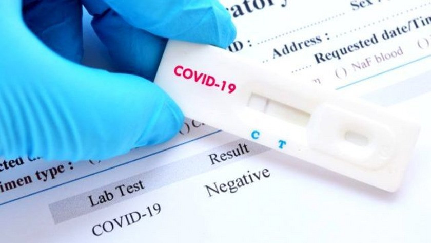 Koronavirüs de yeni teşhis! Akciğer röntgeni ile virüs tespiti