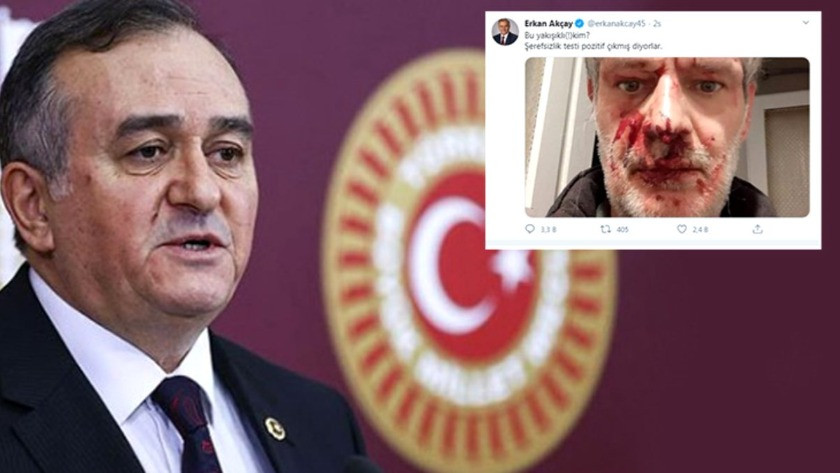 MHP Grup Başkanvekili Erkan Akçay'ın dayak paylaşımı sosyal medyayı karıştırdı