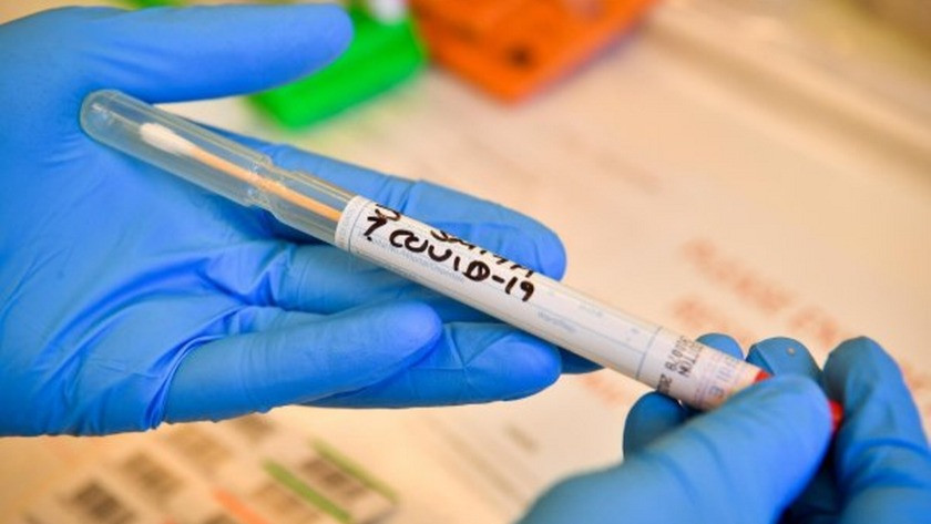 ABD, 5 dakikada sonuç veren koronavirüs testi geliştirdi