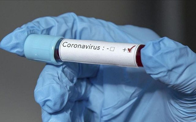 koronavirüsten iyileşenlerin sayısı umut verdi! - Sayfa 3