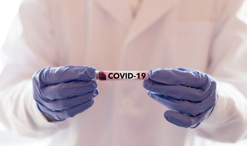 Koronavirus hakkında ne biliyorsunuz ?Kendinize sorularla test edin! - Sayfa 3