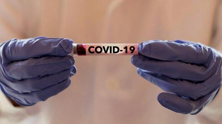 Koronavirüs tedavisinde dev sürpriz ne ? - Sayfa 2