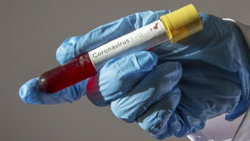 Rusya’da koronavirüs vaka sayısı artıyor!