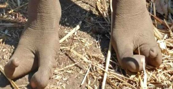 Zimbabwe'de yaşayan bu kabilenin sadece 2 ayak parmağı var ! - Sayfa 1