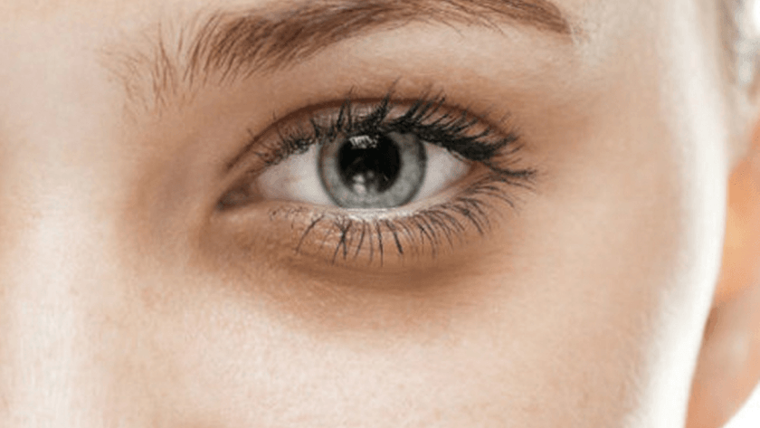 Göz altı morlukları nasıl geçer?Ne gibi yöntemler uygulanabilir?
