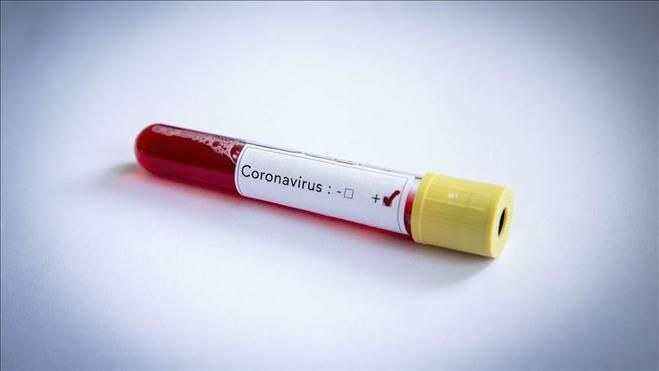 Koronavirüs mutasyona mı uğradı ? Yeni belirtileri neler ? - Sayfa 3