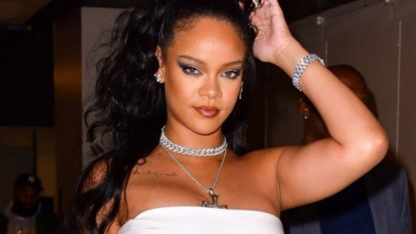 Rihanna’nın yüzündeki morluklar hayranlarını korkuttu