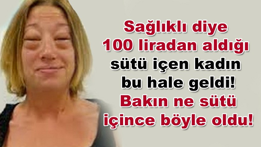 100 liradan eşek sütü alıp içen kadın ölümden döndü