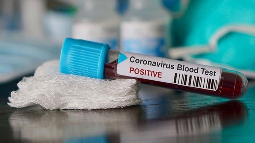 Dünyada koronavirüs vaka sayısı 48 milyonu aştı