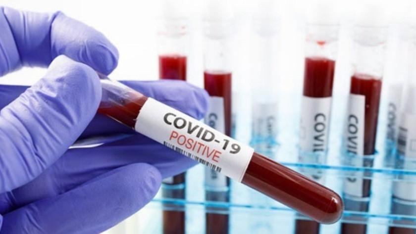 Koronavirüs geçirenlerin bağışıklığın ne kadar sürüyor?