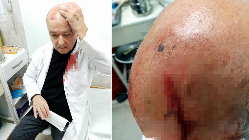 İzmir'de maske uyarısı yapan doktora çirkin saldırı