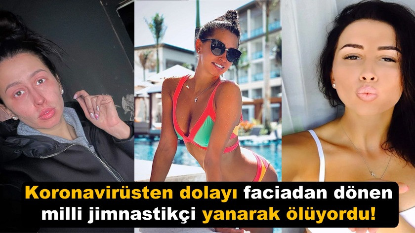 Koronavirüsten dolayı faciadan dönen jimnastikçi yanarak ölüyordu!