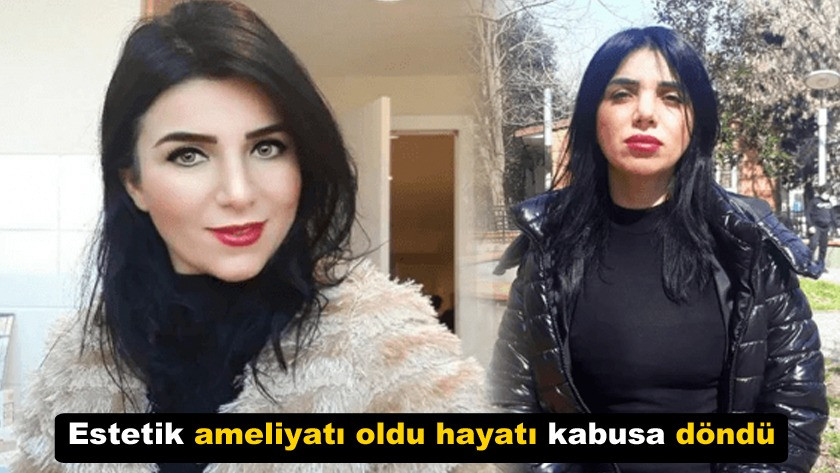 Estetik ameliyatı oldu hayatı kabusa döndü