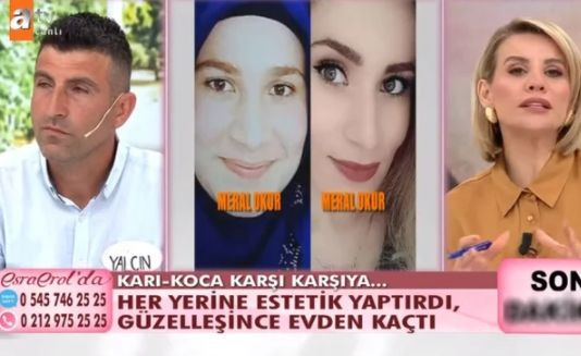 Esra Erol'da Yalçın Okur, estetik sonrası kaçan eşi Meral ile yüzleşti - Sayfa 3