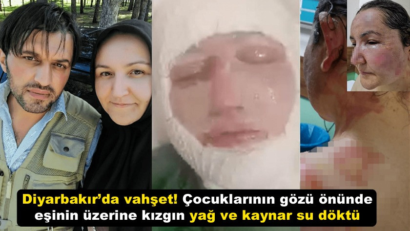 Diyarbakır’da vahşet! Eşinin üzerine kızgın yağ ve kaynar su döktü