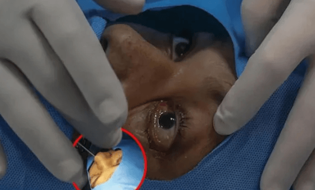 İşte kara mantar ameliyatı: Gözler böyle oyuluyor - Sayfa 1