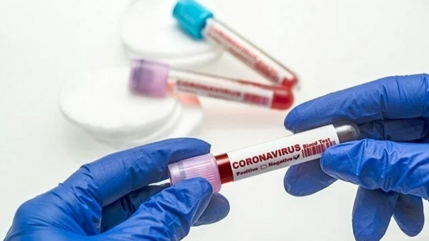 1 Ağustos 2021 günlük koronavirüs tablosu açıklandı!