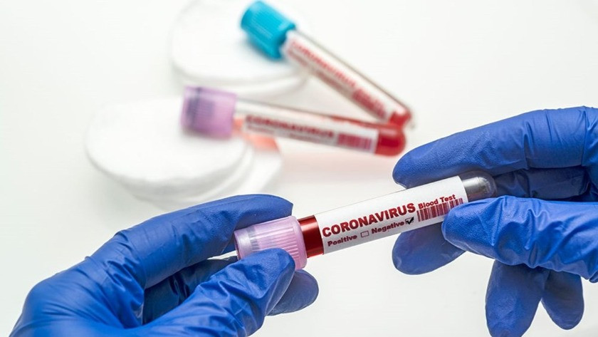 9 Ağustos 2021 günlük koronavirüs tablosu yayınlandı