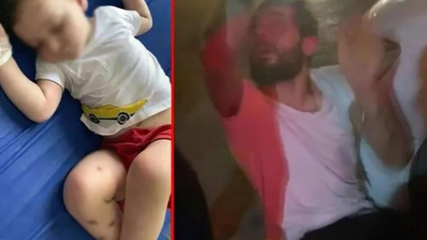 İstanbul'da dehşet! 2 yaşındaki bebeğin tırnakları sökülmüş...