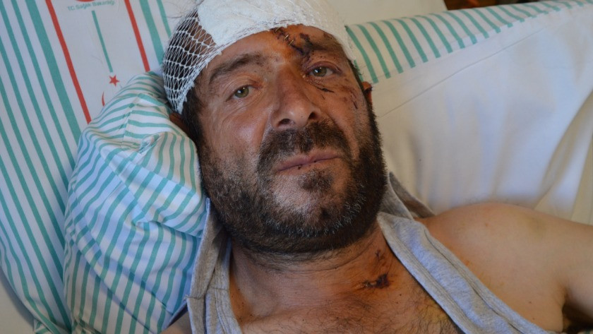 Tunceli'de kabusu yaşadı kanlar içinde kaldı: Beni ayı parçaladı
