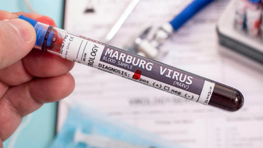 DSÖ salgın ilan etti... İşte ölümcül virüs Marburg'un semptomları