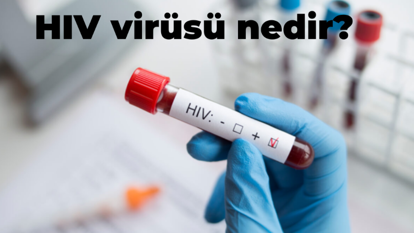 HIV virüsü nedir? HIV tanısı nasıl konur? HIV virüsü nasıl bulaşır?