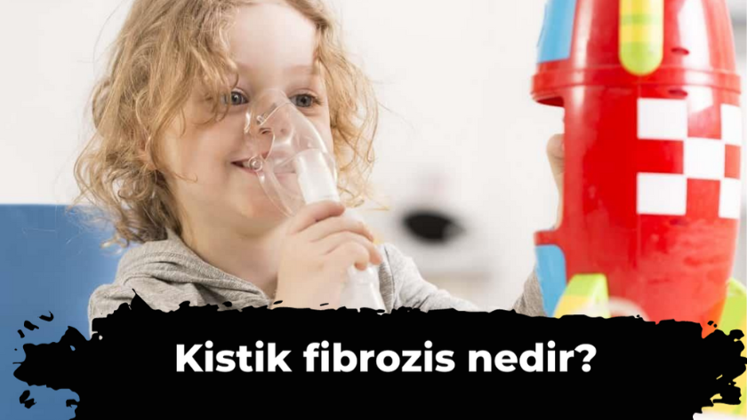 Kistik fibrozis nedir, belirtileri neler? Kistik fibrozis bulaşıcı mı?