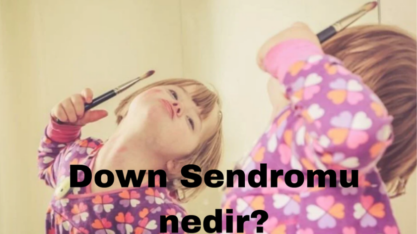 Down Sendromu nedir? Down Sendromu Farkındalık Günü nedir?