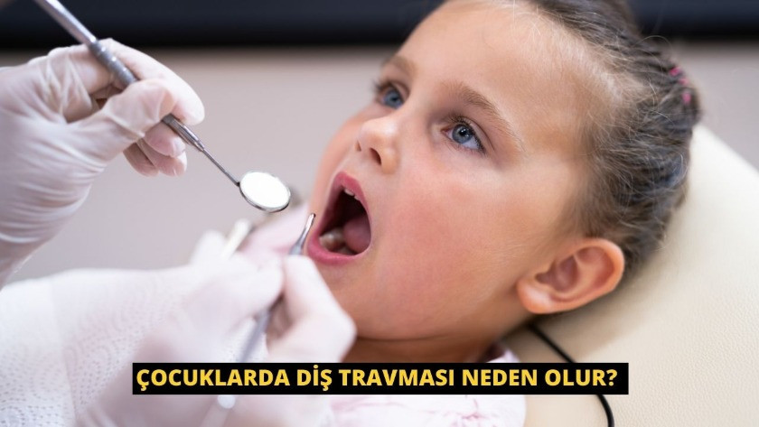 Çocuklarda diş travması neden olur? İlk müdahale büyük önem taşıyor