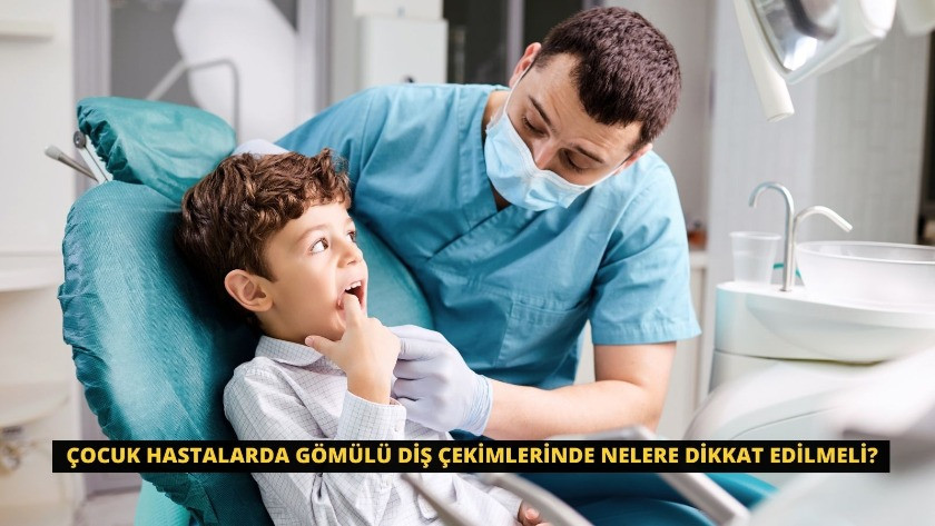 Çocuk hastalarda gömülü diş çekimlerinde nelere dikkat edilmeli?