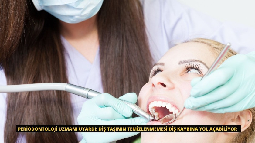 Periodontoloji Uzmanı uyardı: Diş taşının temizlenmemesi diş kaybına yol açabiliyor