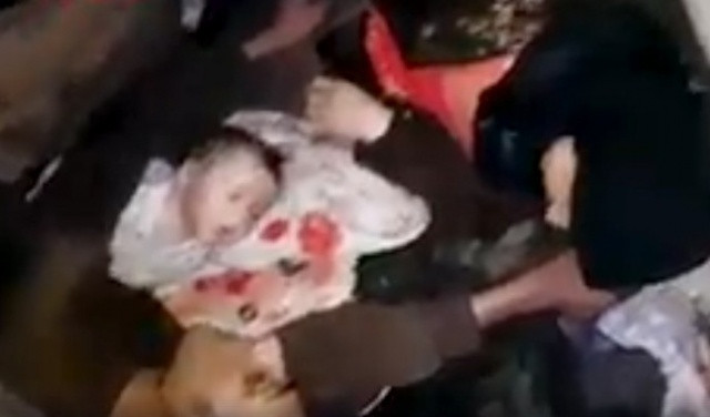 Esad rejimi Duma’ya kimyasal saldırı düzenledi: 75 ölü, 1000'den fazla yaralı - Sayfa 1