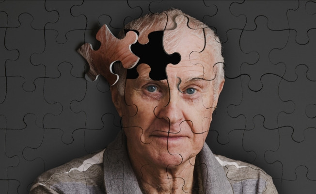 Alzheimer riskini yarıya indiren yöntem ile Alzheimer hastalığının belirtileri neler?