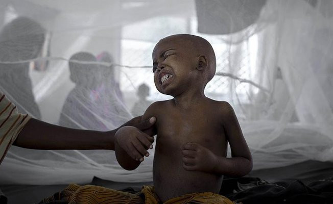 Kenya'da 25 kişide daha kolera tespit edildi