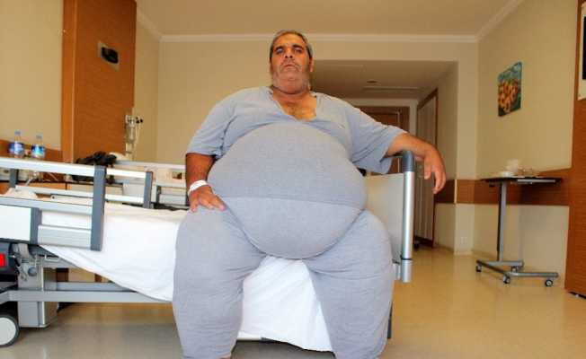 250 kiloya ulaşınca, zayıflamak için tüp mide ameliyatı olmaya karar verdi