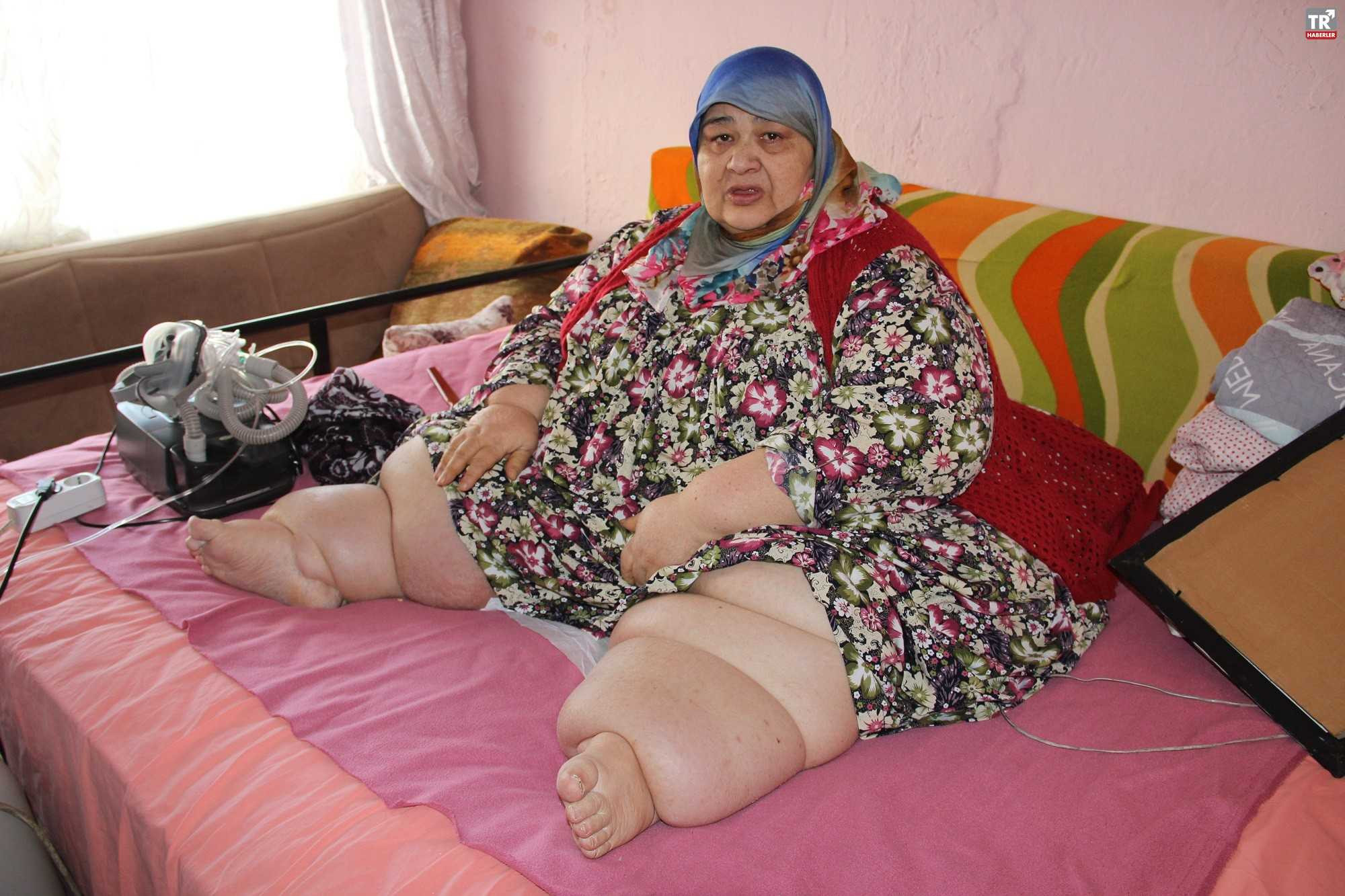 260 kilo ağırlığındaki kadın kilo verebilmek için yardım bekliyor