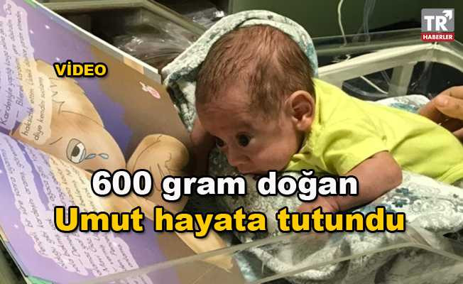 Umut bebek 600 gram olarak doğdu ama hayata tutundu video izle