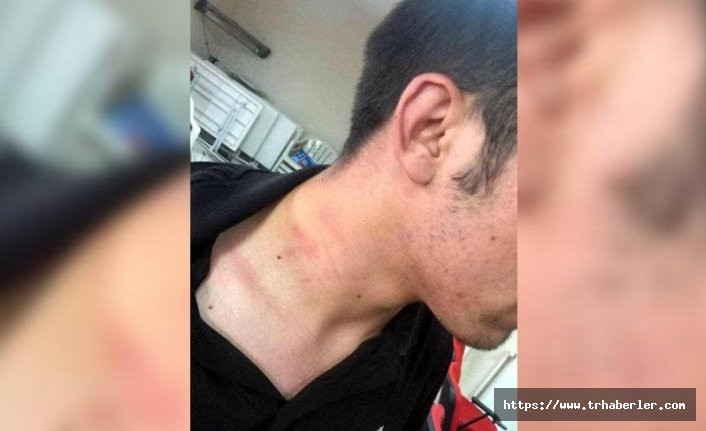 AK Partili vekil tartıştığı CHP’li gencin boğazını sıktı