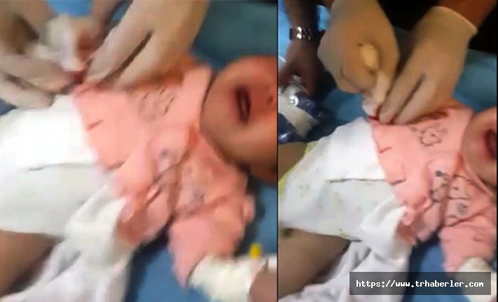 Hastane'de büyük hata! 1,5 aylık bebeğin parmağını kesti!