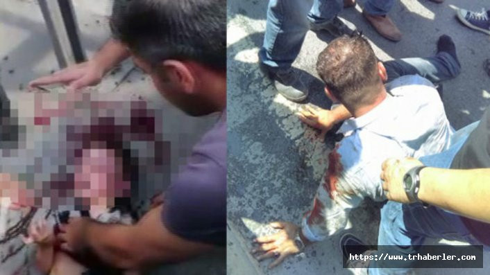 İstanbul Esenyurt'ta babası tarafından dövülen çocuk beyin kanaması geçirdi! Hastane raporundaki kan donduran detay!