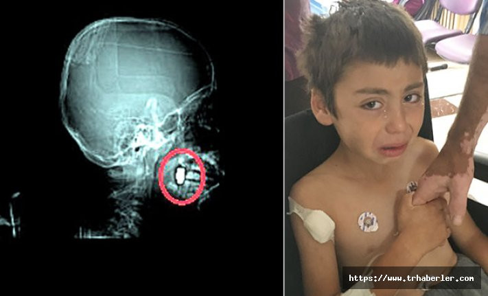 Başına mermi isabet eden çocuk yaralandı