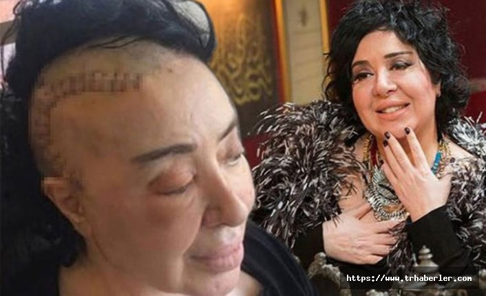 Beyin ameliyatı olan Nur Yerlitaş son halini paylaştı!