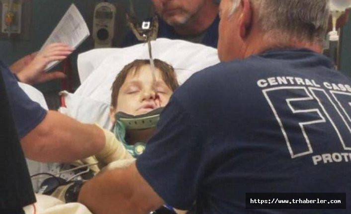 Kafasına 30 santimetrelik şiş saplanan 10 yaşındaki çocuk hayatta kaldı!