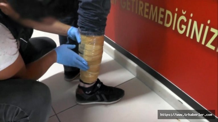 Polis Bile Görünce Çok Şaşırdı Bacaklarına Sarılı Bandın Altından…
