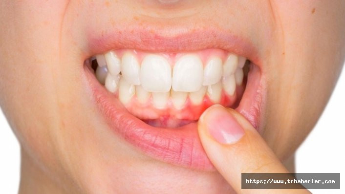 Dişlerin gelişimi için hangi besinler tüketilmelidir?