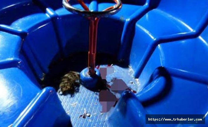 Parkta oyuncağa saçı kapılan çocuk feci şekilde yaralandı